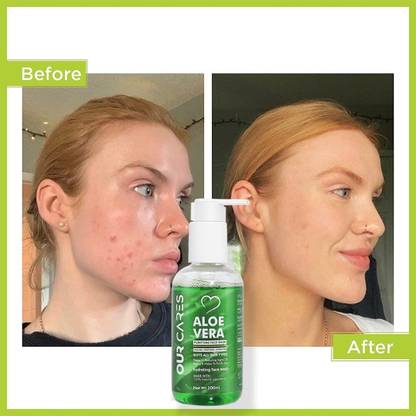 Ourcares Aloe Vera  Gel: Restore Your Skin's Natural Beauty Face Wash