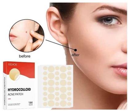 Ramley Products Clear Skin Essential: 144 Pimple Patches in a Convenient Box