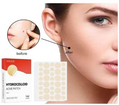 Anywell Products Clear Skin Overnight: Hydrocolloid Acne Patches for Quick Healing