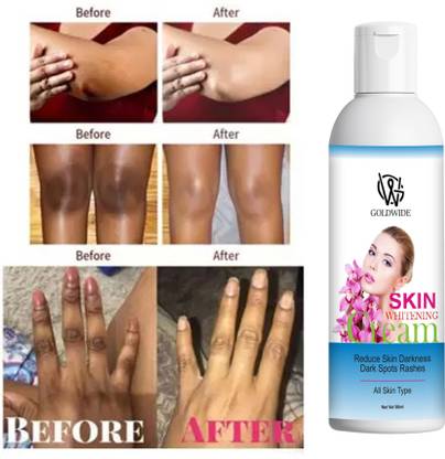 GOLDWIDE Reduce Dark Spots Face Moisturizer Fairness Face Pack