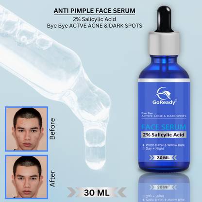 GoReady /| 2% Salicylic Acid Serum with Witch Hazel & Willow Bark for Active Acne