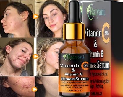 Raiyani Vitamin C Serum 15% L-Ascorbic Acid and 1% Vitamin E Brightening Serum