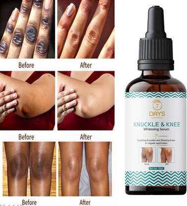 7 Days Fast Whitening Serum For Removing Dark Knuckles Elbow and Knee