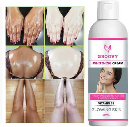 GROOVY Whitening Cream | Whitening & Brightening (50 ml) Pack Of 1