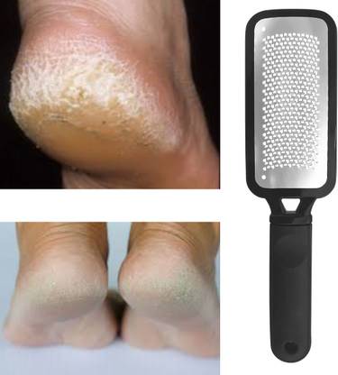 SIYDHA Foot Scrubber Tool For Heel Crack Remover , Dead Skin & Heel Repair