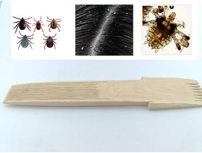 Handymade Hand Made Wood Comb For Lice Removal | Lice Eggs Removal | Adults & Kids