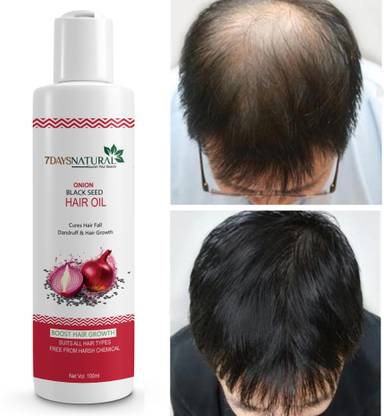 7days natural Onion Oil for Hair Regrowth | Anti Hair Fall | Dandruff | smooth shine hairs Hair Oil