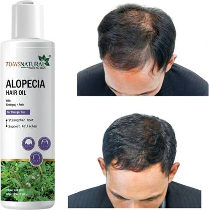 7days natural Hair oil | Ginger, Shikakai |Anti Hair Fall Dandruff |New Hair Growth Hair Oil