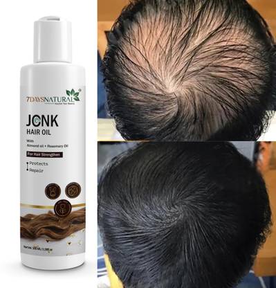 7 Days Premium jonk oil for hair fall control & hair regrowth leech Hair Oil