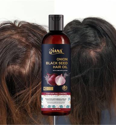 Qiana Onion Luxe Scalp Oil – 100ml Unisex Solution Hair Oil
