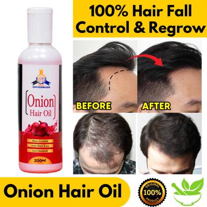 bmc outsourcing Onion Hair oil for men Hair Oil