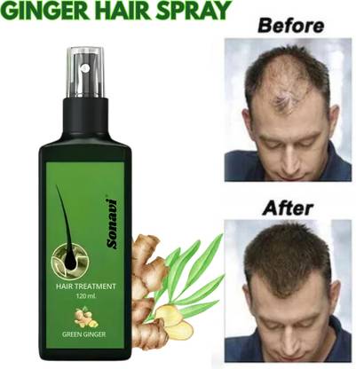 Sonavi Hair Oil for Shiny Hair Long & Dandruff Control  Hair Oil