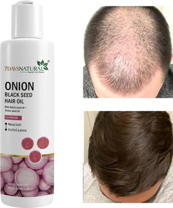 7days natural Oil With Black seed stop hair loss | anti hair |fall dandruff Hair Oil