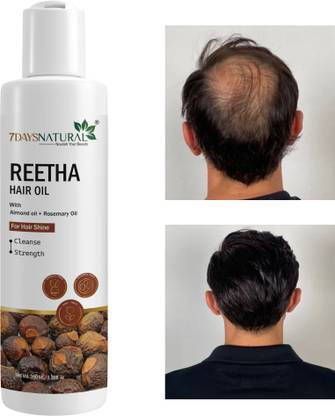 7 Days Cold-Pressed 100% Pure Reetha Oil paraben free for hair regrowth hair fall Hair Oil