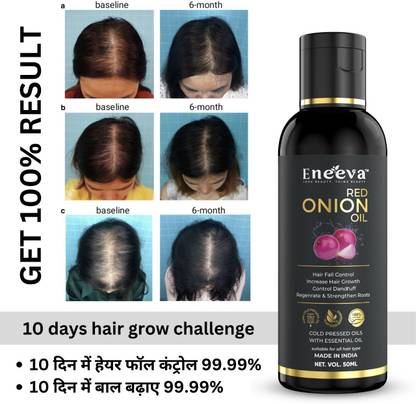 eneeva Red onion hair oil Hair Oil