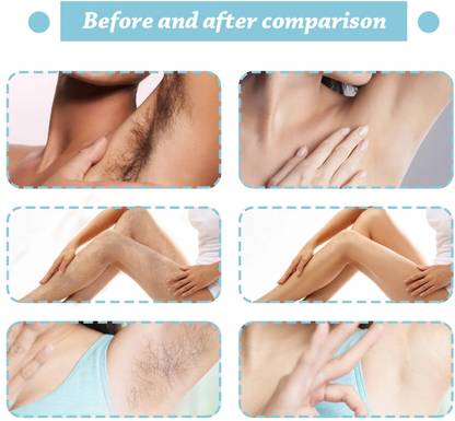 Neycare Fast & Easy to Used Hair Remover for Underarm, Chest, Back, Legs and Arms Cream