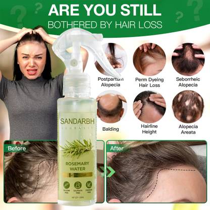 Sandarbh Herbal Rosemary water for Anti-Hair Fall Hair Spray Hair Oil