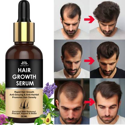 INTIMIFY Hair Growth Serum | Helps Reduce Fizz & Adds Shine | For Women & Men