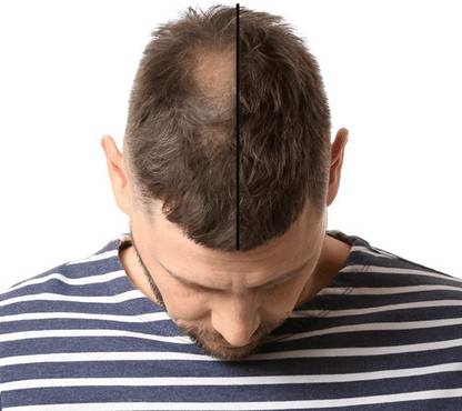 ADJD Hair Thickening Hair Build Fiber Spray Cover Grey Hair Spray
