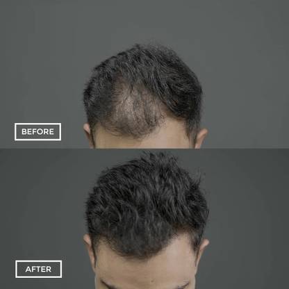 imelda Hair Building Fibers Black For Men ANd Women KSSEP25 Extreme Hair Volumizer Hair Fiber
