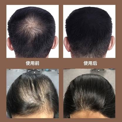 GULGLOW99 Best Natural Black Hairline Powder|Long Lasting Hair Shading Sponge Pen