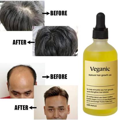 Regolith Natural Hair growth oil for Damage Repair Long Hair Men & Women