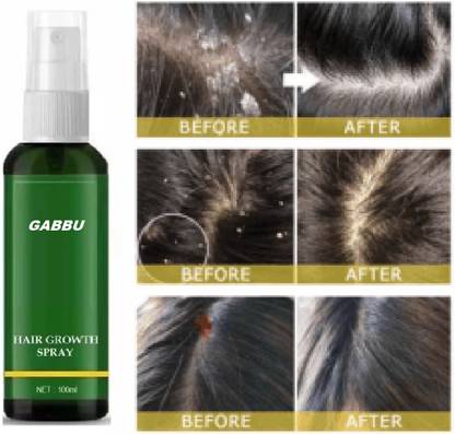 GABBU Hair Growth Spray Extract Prevent Hair Loss Growing Hair For Men Hair Spray
