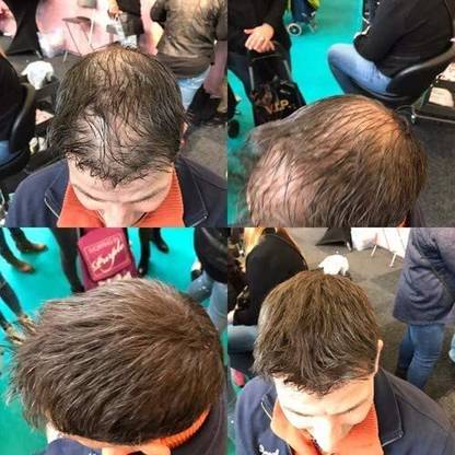 Osking Hair Scalp Concealer Hair Filler Powder 548 thickness & thinning areas Hair Volumizer powder