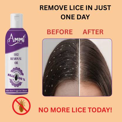 Ammi Lice Removal Oil 100g | Eliminates Lice, Nits & Eggs | Herbal Solution