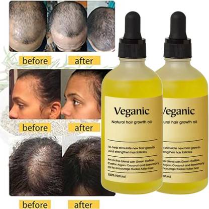 Veganic Natural Hair growth oil for Stress Relief Smooth Hair Hair Oil
