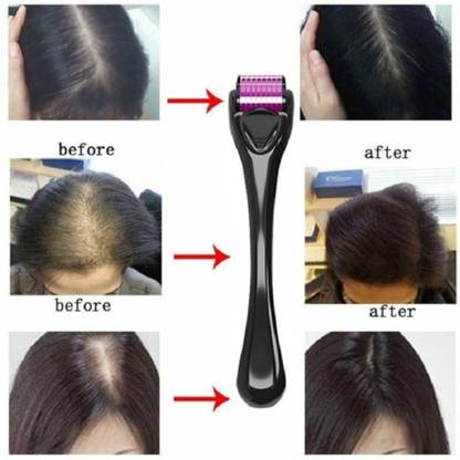 SIYDHA Best Derma Roller 0.5 Mm Scalp Massager For Beard & Hair Growth