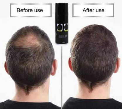 REIMICHI Black Cover-Up Concealer Hair Spray For All Man & Women Hair Spray AR123 Extreme Hair Volumizer SPRAY