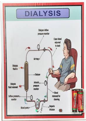 MELODY's MODEL OF DIALYSIS Working Science Model For School Project .