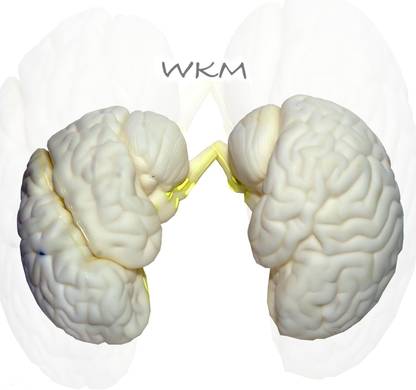 wkm 3D Human Brain Model Structure Life Size Anatomy Removable in 3 Parts