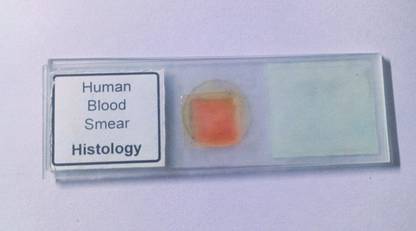 SEP Human Blood Smear Prepared Slide
