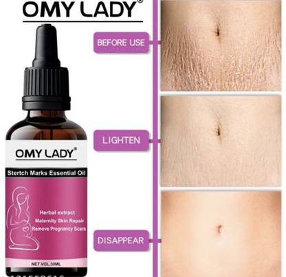 Omy Lady Repair Stretch Marks Removal Oil