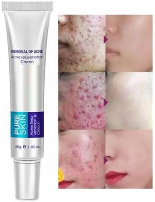 MYEONG pigmentation Cream Acne Scar Removal Cream