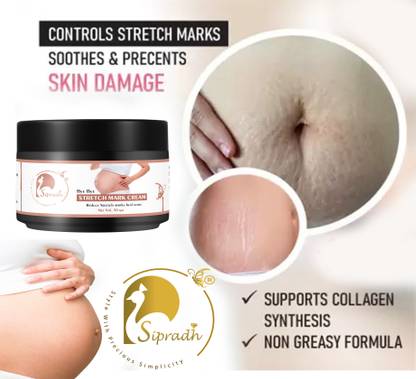 Sipradh Pregnancy and maternity Stretch marks Removal Cream