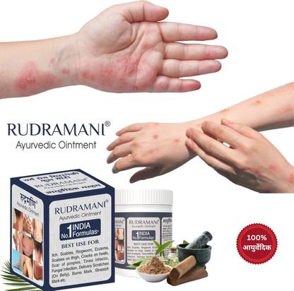 Rudramani Ayurvedic malam Anti fungal Malam - for Ringworm, Eczema & Fungal Infection