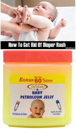 Sofskin Baby Petroleum Jelly (Anti Diaper Rash) 368 gm