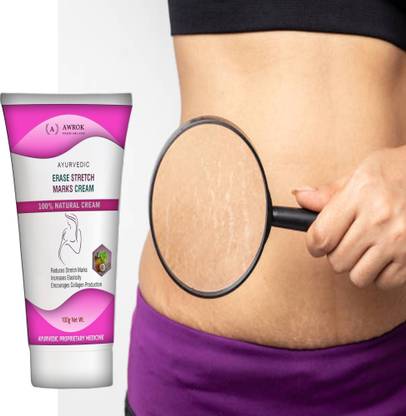 AWORK Stretch Mark Cream to Reduce Stretch Marks & Scars