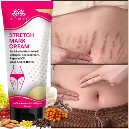 इतनीमफी Pregnancy Stretch Mark Cream, Moisturises & Soothens Skin for women