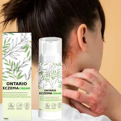 Ontario Herbal Eczemaron Cream PACK OF 1.5