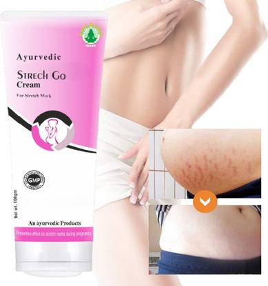 wvhc Stretch Marks Removal Cream, Reduce Scar Before & After Pregnancy For Women