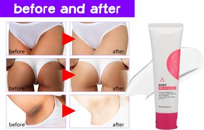 HUZURLU Whitening Cream for Dark Spots