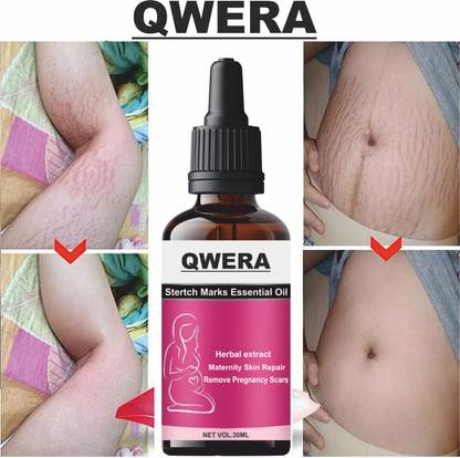 Qwera Stretch Marks Oil to Reduce Stretch Marks & Scars