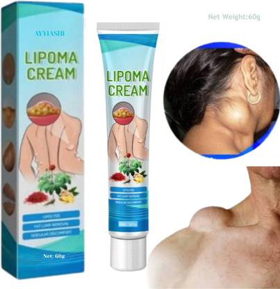 AYYIASHI Lipoma Fat Removal Cream – Natural Herbal Fusion