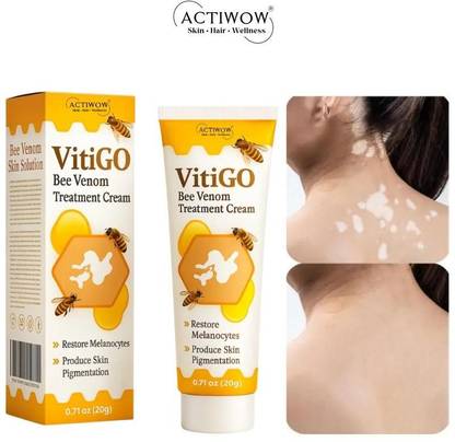 ACTIWOW Vitigo Bee Venom Cream for Clean Skin Support cream Moisturizer