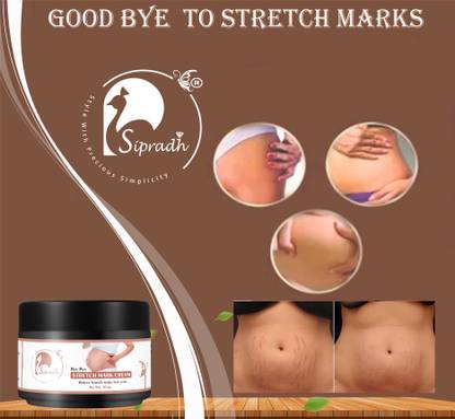 Sipradh Body Pregnancy Stretch Mark Removal cream Scar Removal Skin Hydration