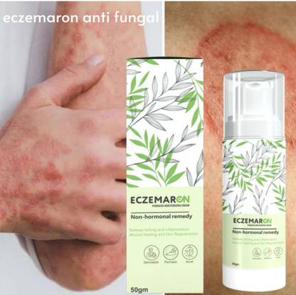 BUJANA'S Eczemaron Anti Fungal Cream For Men & Women